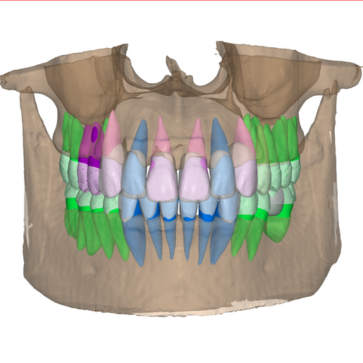 Ortho planning tps