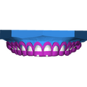 Crown Lengthening 2