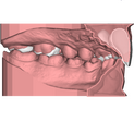 Ant Deprogrammer 3