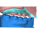 Ant Deprogrammer 5