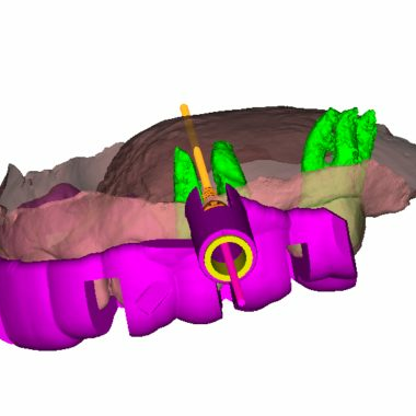 TAD Guide3