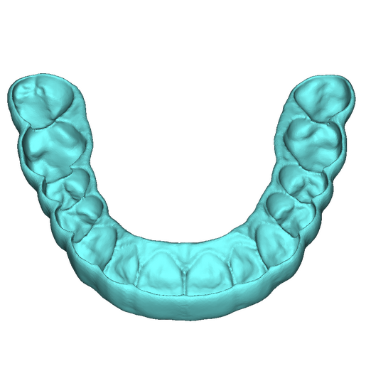 Bite Splint 6