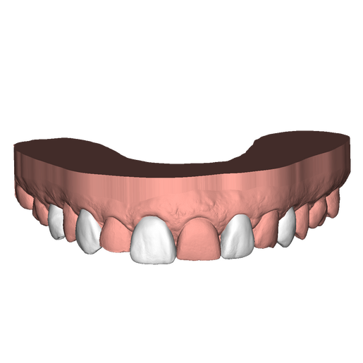 DSD Upper Direct 1