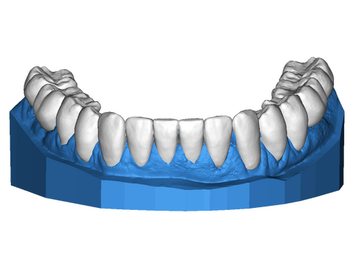 DSD Lower Design