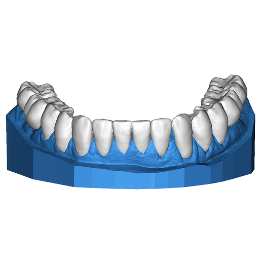 DSD Lower Design