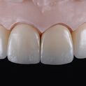 Natural Restauration 4