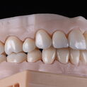 Natural Restauration 6
